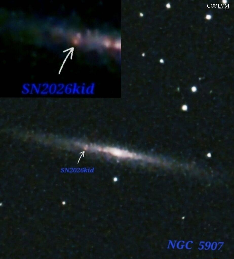 Supernova 2026kid
